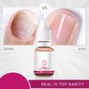 10ml Nail Serum For Cracked And Damaged Nails Cuticles Effective Nail Serum