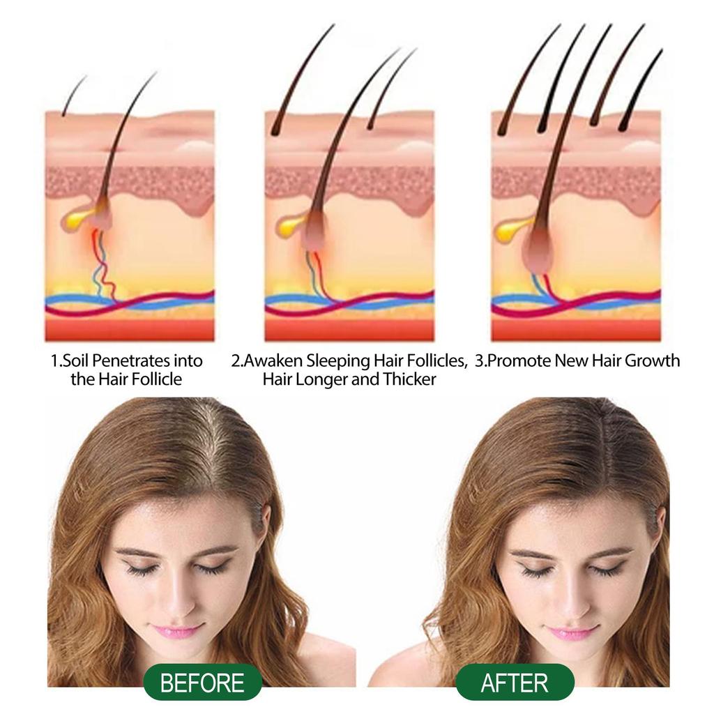 EELHOE Твердый шампунь с розмарином 100 г против выпадения волос, для восстановления волос, для роста волос, мыло-шампунь для ухода за волосами, растительные шампуни для волос