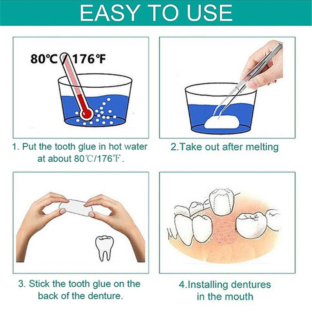 New 100Pcs Dental Temporary Crown Veneers for Anterior Front Teeth Whitening