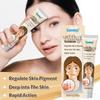 Treatment Moisturizing Cream White Spot Disease Vitiligo Balm Repair Ointment