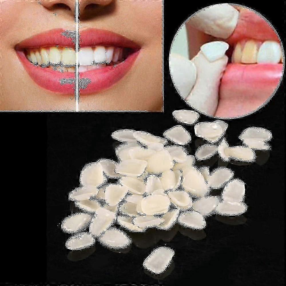 Dental Ultrathin Composite Resin Veneers for Upper Anterior Teeth Restorative, Goj Brand