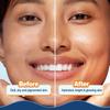 Aqualogica Glow+ Hydra Gel Moisturizer For Glowing Skin With Water Gel Texture, 24 Hour Hydration, Non Sticky Feel 100 g