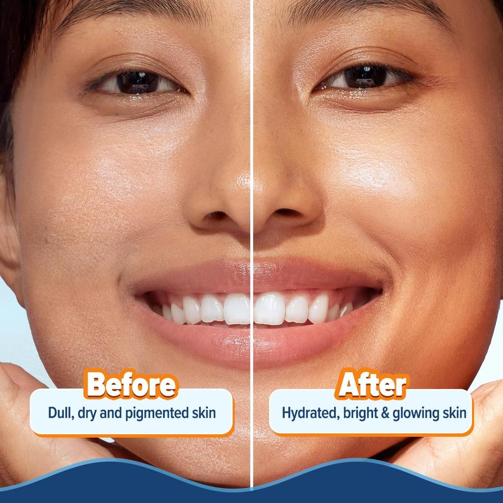 Aqualogica Glow+ Hydra Gel Moisturizer For Glowing Skin With Water Gel Texture, 24 Hour Hydration, Non Sticky Feel 100 g