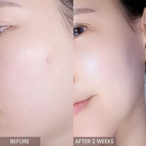 APLIN Сыворотка-синергия с розовым чайным деревом 30 мл, Увлажняющая сыворотка для чувствительной и жирной кожи, Корейская косметика [Официально]