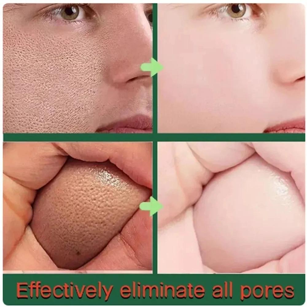 Крем от акне с салициловой кислотой для лица против черных точек, лечение акне и расширенных пор, увлажняющий крем для ухода за кожей - 50 г