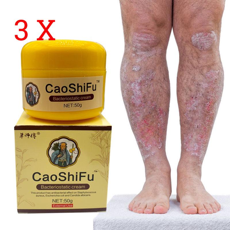 Мазь для ухода за кожей Противозудная Антибактериальная, Натуральная мазь Облегчает различные кожные проблемы 50г