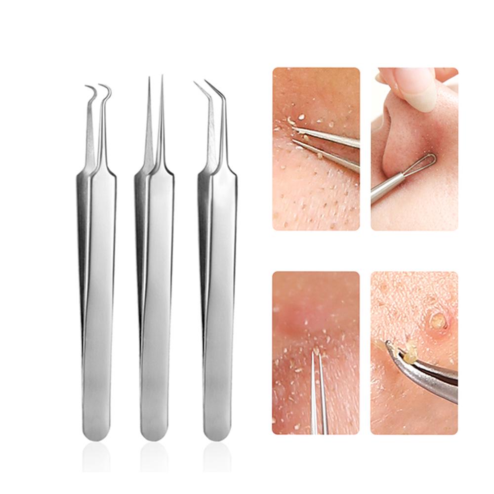 Quality Stainless Steel Blackhead Extractor Blackhead Remover Tweezer for Pimple Blemish Comedones