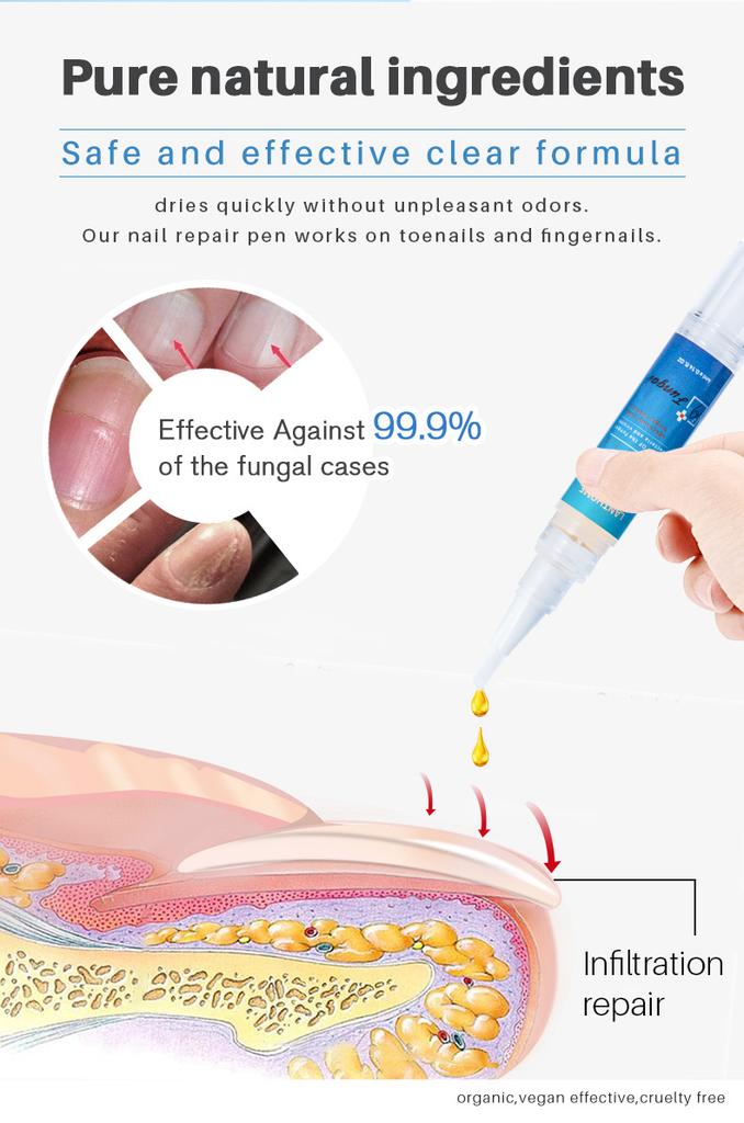 Nail Care Pen – Cuticle & Hangnail Remover, Softens & Strengthens Nails, Fungal Nail Care Treatment less