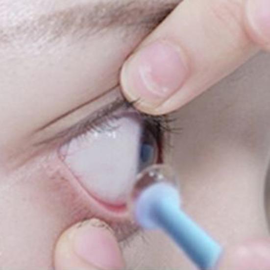 1/6/12Pcs Contact Lens Plunger Sufficient Quantity Easy Contact Lens Removal Tool with Strong Suction Power Clear Blue Silicone Lens Remover for Safe