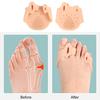 1 пара силиконовых разделителей пальцев ног, ортопедические распорки для пальцев ног, многоразовые распорки для выравнивания стопы, выпрямители для мужчин и женщин