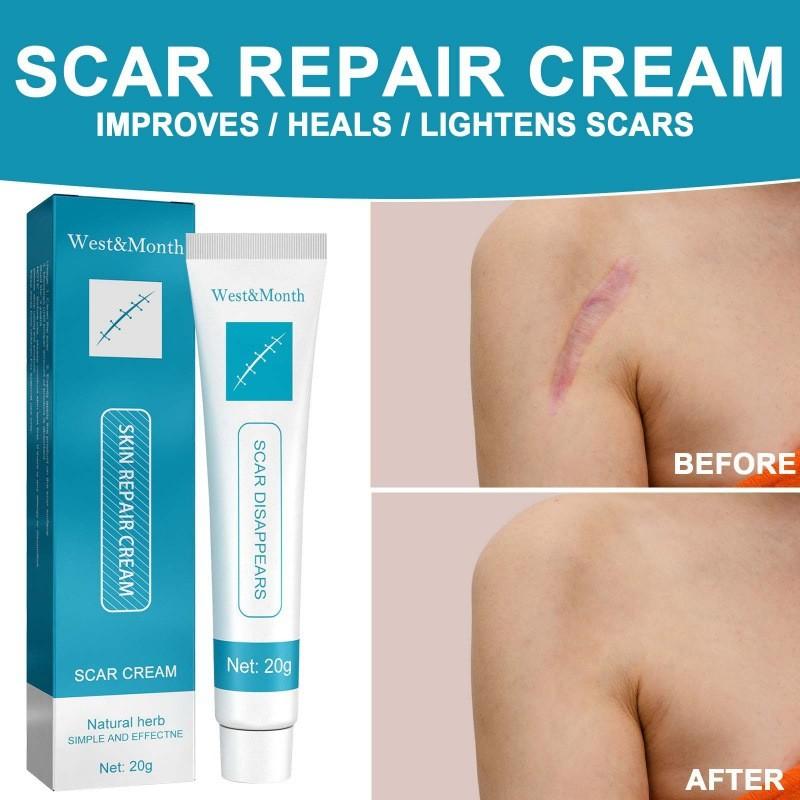 West Month Scar Repair Cream For Reducing Hypertrophic Scars And Pregnancy Marks