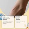 Keloid Bumps Removal Gel, Advanced Scar Gel for Face & Body, Scar Gel for All Scars & Keloids