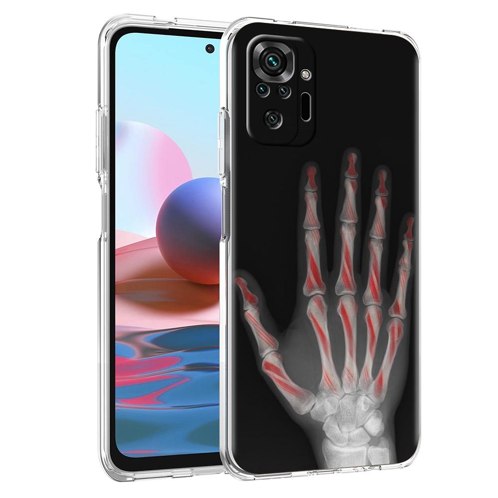 Прозрачный чехол для телефона для Redmi 14C 13C 10C 10 9 Note 13 12 11 K50 K40 Plus Pro 4G 5G Мягкий ТПУ чехол Осень Рентген Кости Руки