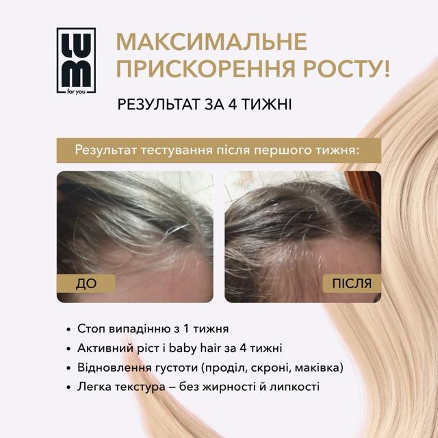Набор LUM "90-дневный курс": активация фолликулов и формирование плотности"