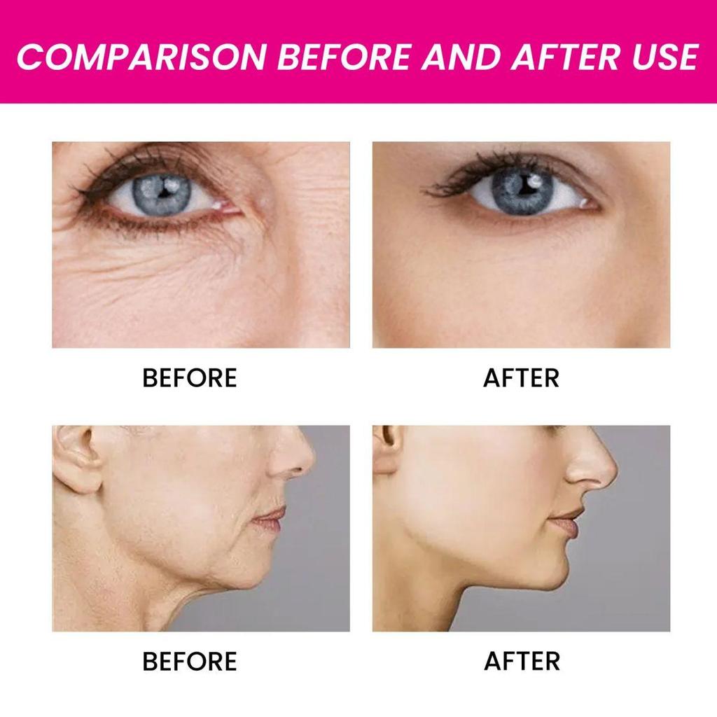 Retinol Moisturizing Cream, Smooths Wrinkles, Reduces Fine Lines, Hydrates and Moisturizes, Nourishes the Skin, and Improves Damaged Skin