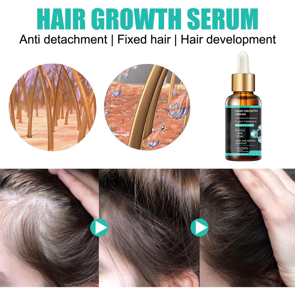 Dense Hair Repairing, Moisturizing, Dry, Hairy, Dropping, Strong, Firm And Thick Hair Care 20ML