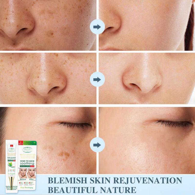 Крем против пятен, питающий кожу, увлажняющий, лифтинг, укрепляющая косметика, удаление веснушек, прыщей, пигмента, меланина, крем для лица