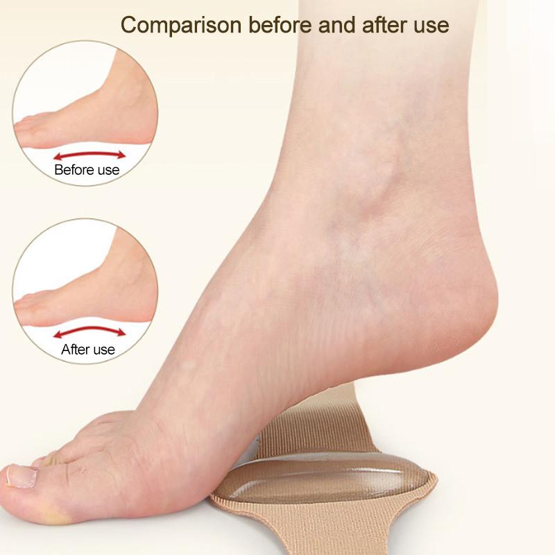 1 пара рукавов для поддержки свода стопы, компрессионный бандаж для плюсневой кости для поддержки плоскостопия и облегчения подошвенного фасциита