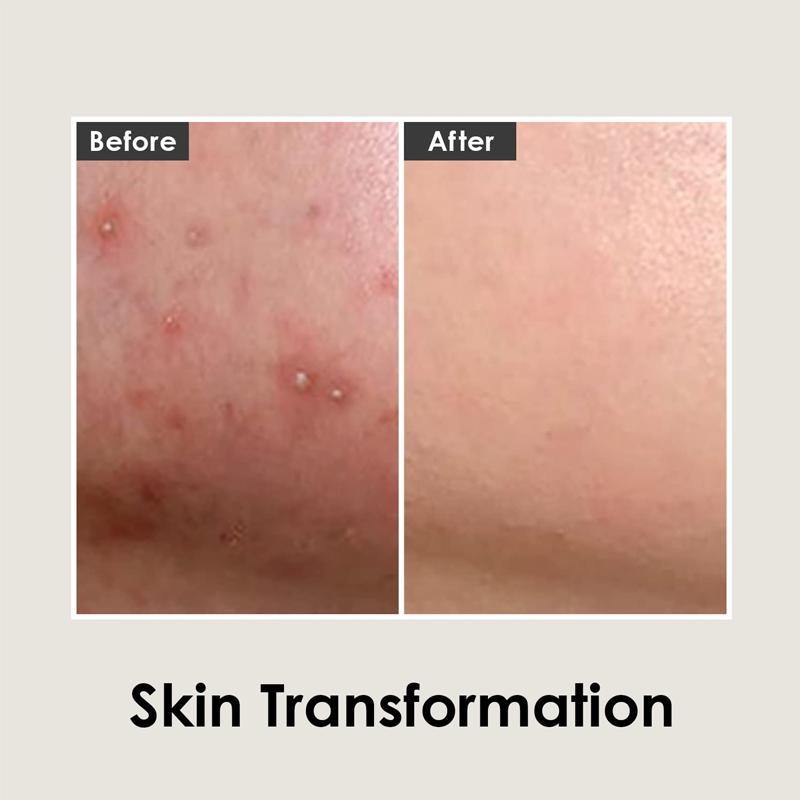 MEDI-PEEL Cica Антио крем 30мл