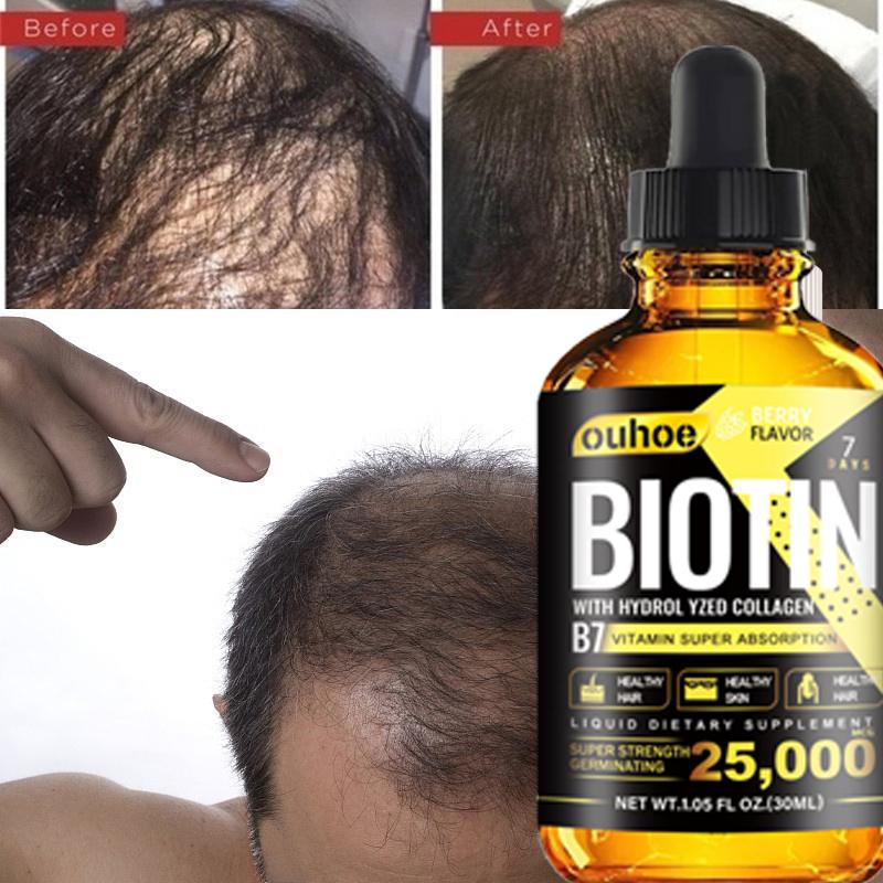 Nutrition Biotin Liquid Drops Essential Oil Collagen B7 Vitamin Oil Trengthen Hair Root Anti Hair Weak Treatment Anti Hair Loss Essence Oil Product