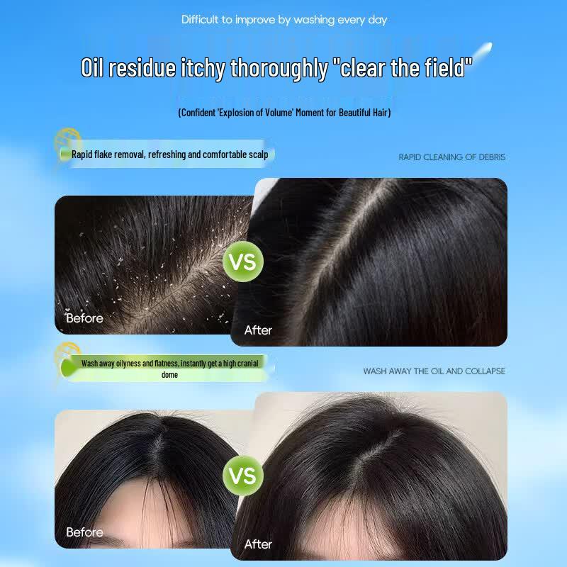 RUYI Teen Anti-Dandruff & Oil Control Shampoo