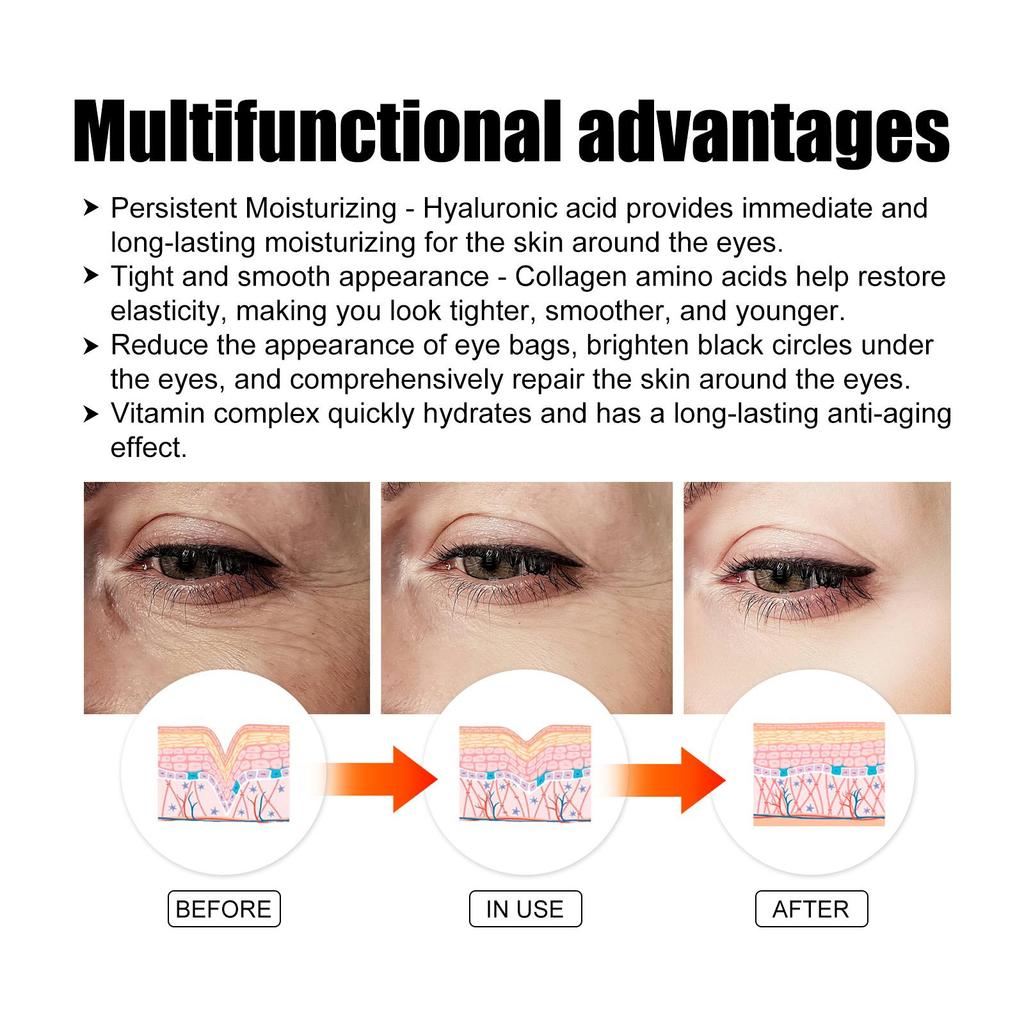 EELHOE Коллагеновые золотые патчи для глаз 12 шт. Уменьшают темные круги и отечность, разглаживают морщины и подтягивают кожу, увлажняющие патчи для глаз