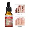 10ml Nail Essence Fast Absorption Protect Painless Reduce Dry Quick Effect Onychomycosis Heal Pedicure Care Nail Fungus Treatment Feet Care Essence