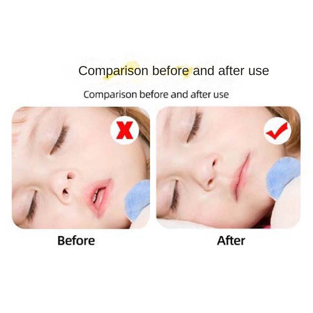 30Pcs/set Prevent Open Mouth Sleep Children Anti-Snoring Mouth Tape Stop Snoring Stickers Household