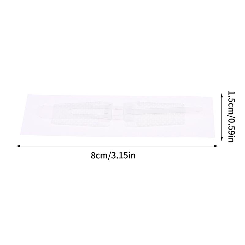 1 шт., пластырь на молнии, безболезненное устройство для закрытия ран, без швов, пластыри для повязки на рану, пластырь для уменьшения швов на молнии