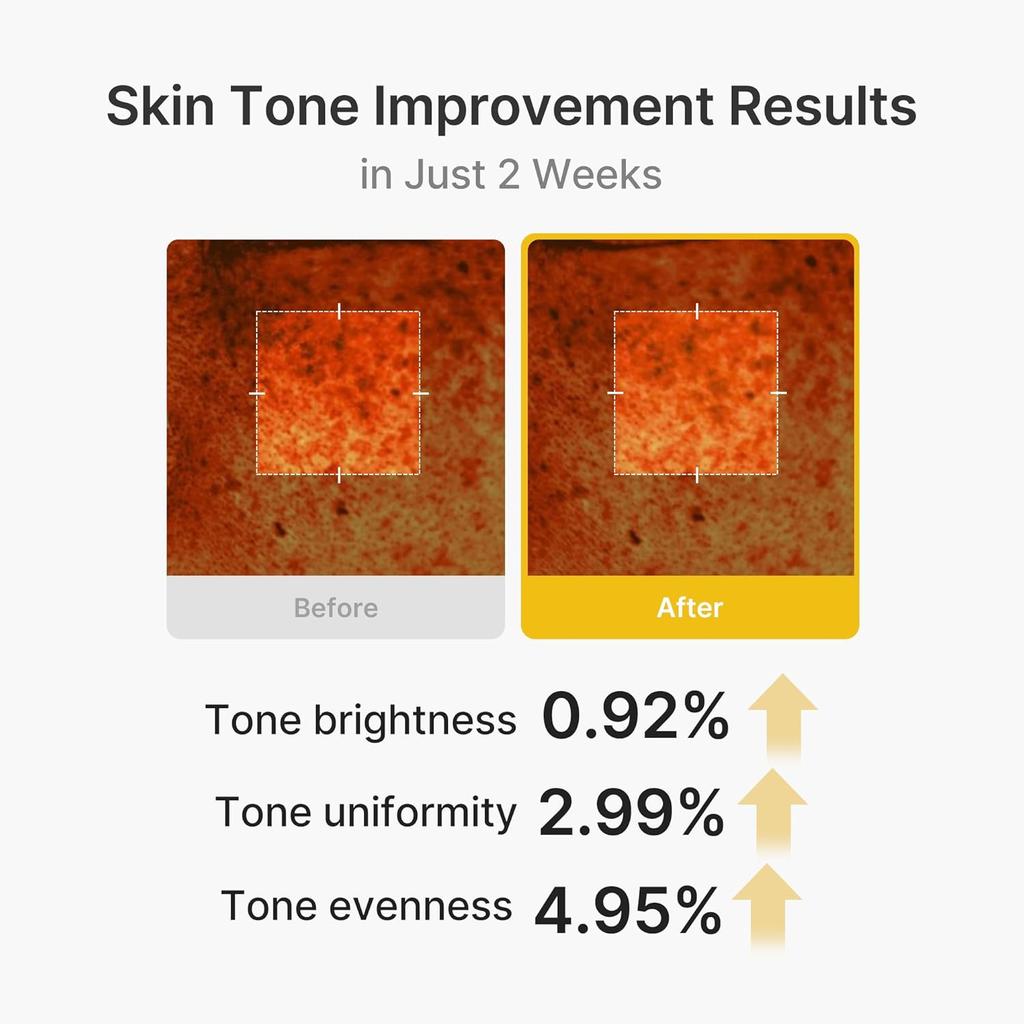 Medicube Capsule Cream with Kojic Acid and Turmeric for Uneven Skin Tone, Repairs Damaged Skin, Deep Moisturizing, Brightening, All Skin Types, 50ml