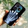 For ZTE Blade V60 Design Case V60Vita Luxury Fashion Soft Silicone Shockproof Phone Case For ZTE Blade V60 Vita Back Cover Coque