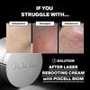 PURCELL Крем Pixcell Biom™ после перезагрузки 50 мл