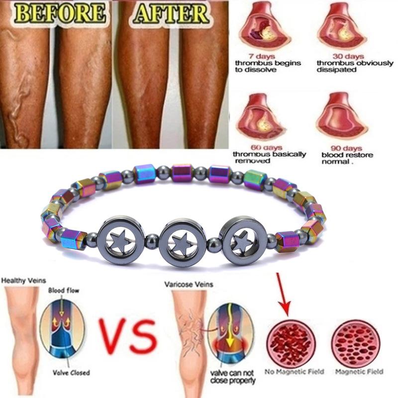 Красочные гематитовые энергетические магниты, браслет, женский браслет с цветным камнем, магнитная терапия, браслет для здравоохранения, очаровательные ювелирные изделия
