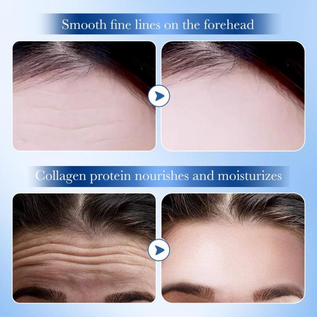 Hyaluronic Acid Collagen Firming Forehead Patch To Improve Forehead Lines 5pcs