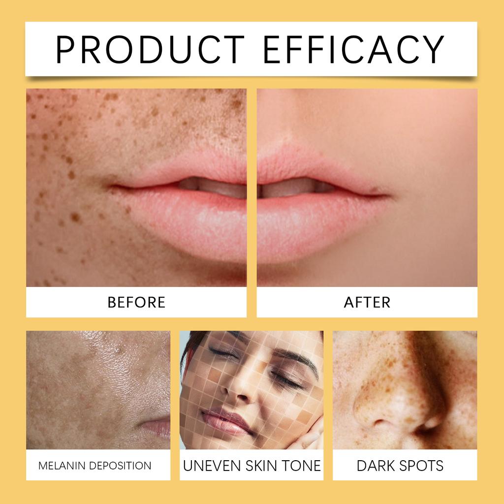 30ml Vitamin C Brightening Serum with Turmeric Extract Niacinamide Face Moisturizer Hydrating Glow Booster for Even Skin Tone