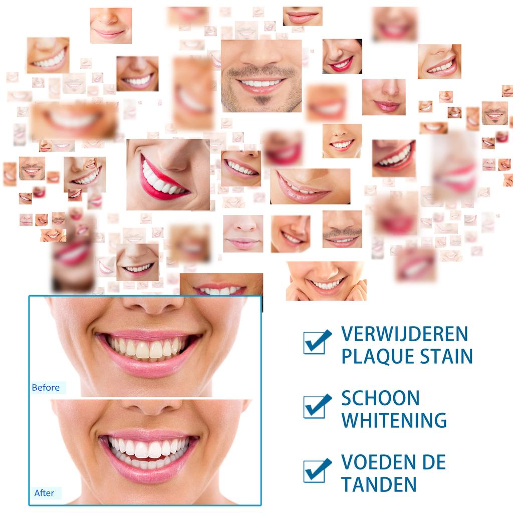 2023 Новинка, ручка для отбеливания зубов, гель для отбеливания зубов, отбеливатель, удаление пятен, мгновенная улыбка, набор для отбеливания зубов, чистящая сыворотка, красота, здоровье