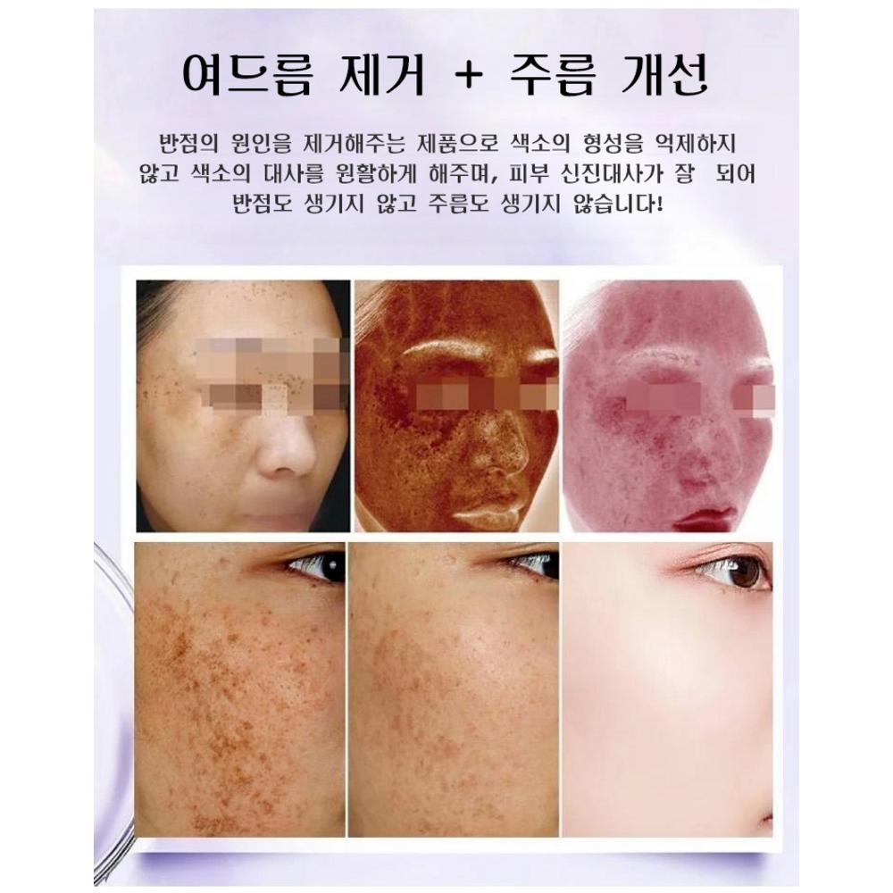 100Ml+100Ml 2 Week Spot Removal Anti-Aging Mask Wrinkle Improvement Whitening Mask Brightening Mask Pack, 2 Pieces: 100Ml+100Ml