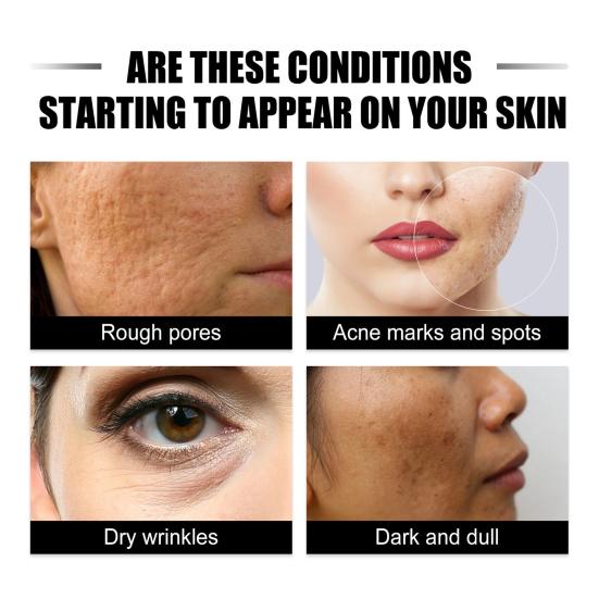 Ginseng Snail Anti-Aging Essence Осветляет тон кожи Осветляет мелкие морщинки Восстанавливающая сыворотка для веснушек Сужает поры Подтягивающая укрепляющая эссенция Средство по уходу за кожей