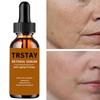 TRSTAY Anti Wrinkle, Anti-Aging, Firming Serum Hyaluronic Acid, Vitamin A, Retinol Face Cream, Can Reduce Wrinkles And Black Spots In Women