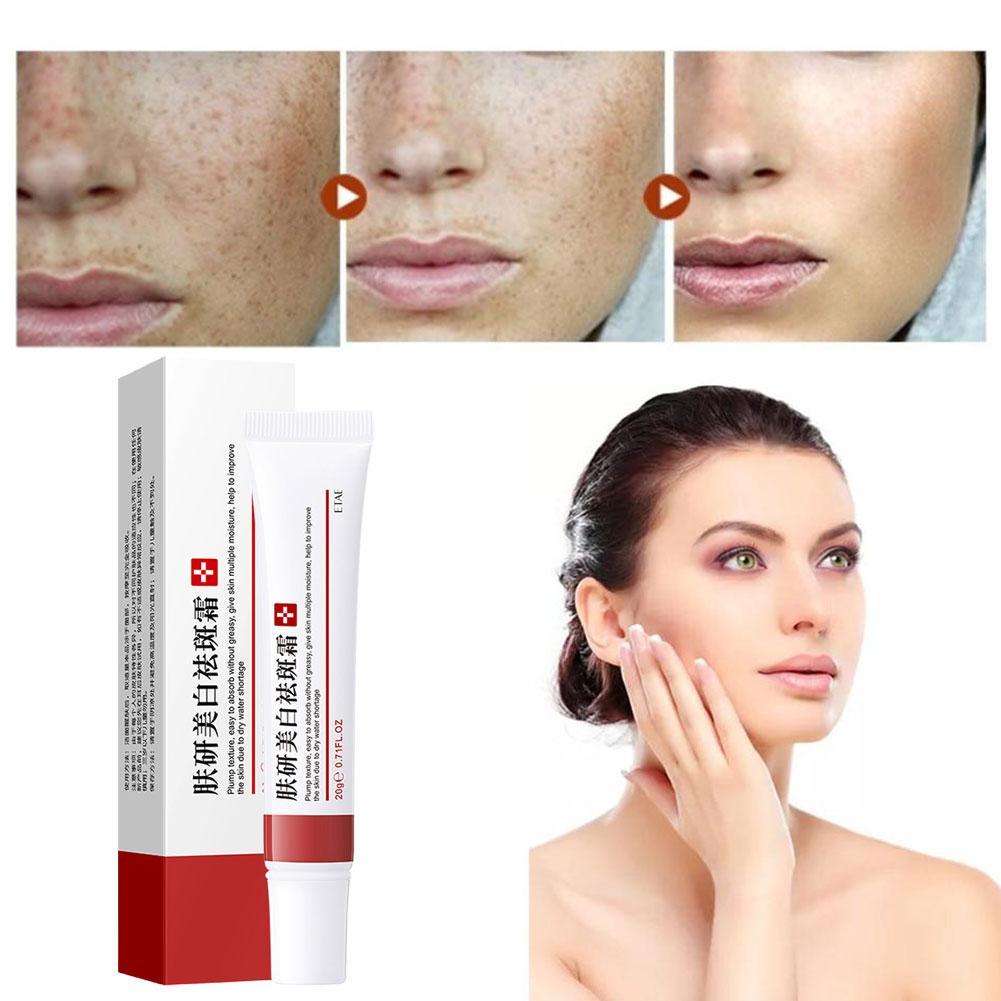 Крем для удаления прыщей, крем от веснушек, сужающий поры, отбеливающий, увлажняющий, контроль жирности, крем от прыщей, уход за кожей, лечение прыщей, крем для лица