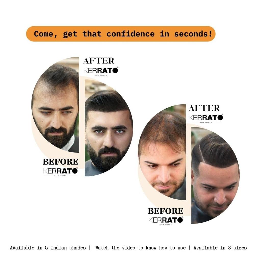 Hair Fibres For Thinning Hair (Light Brown) Natural, 11.5g - Conceals Hair Loss In 10 Seconds - Natural Hair Thickener & Fibers For  Unisex