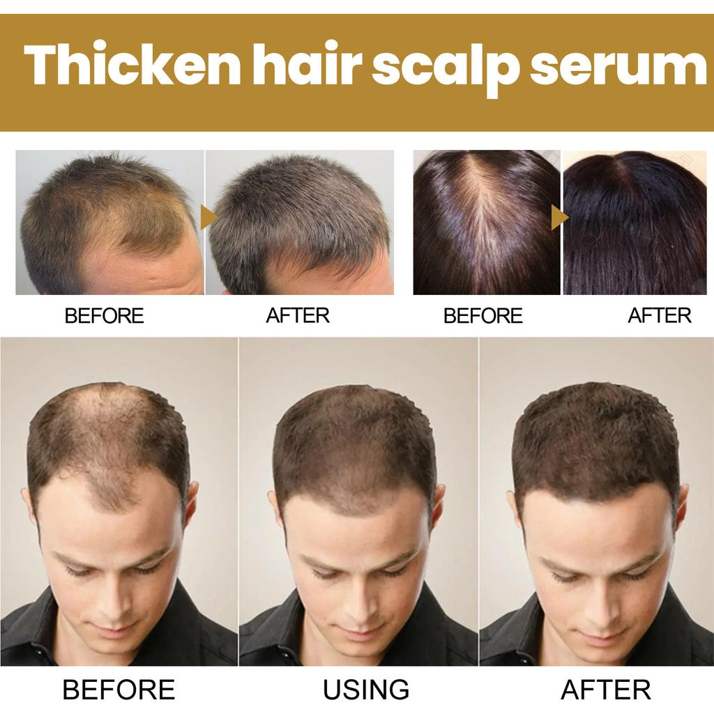 120ml Turmeric Shampoo Moisturizes Hair, Fights Dry Hair, Daily Hair Care, Suitable for All Hair Types, Perfect Holiday Gift