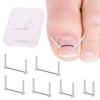 Ingrown Toenail Correction Wire Foot Care Tools Professional Treatment Recover Embed Toe Nail Pedicure Straightening Toe Tools