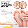 YOUNG VISION 7 дней Сыворотка для восстановления ногтей, Укрепляет и восстанавливает поврежденные ногти