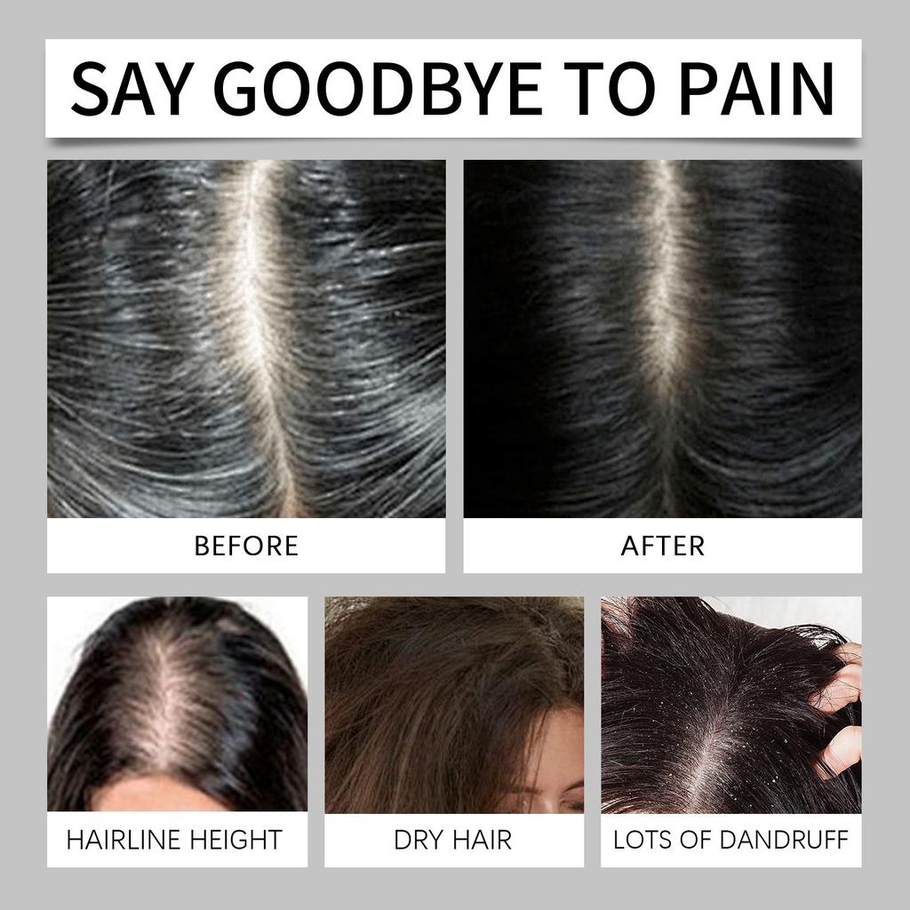 Шампунь с рисом, очищающий массаж кожи головы, увлажняющий и разглаживающий волосы, питательный шампунь