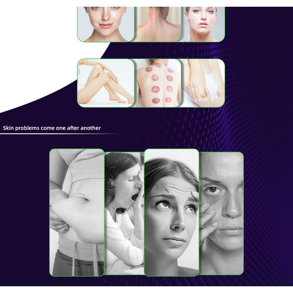 9-в-1 40 кГц Кавитация 0,5 МГц РЧ Лазер 9 Голов Светодиодный Сенсорный экран Воздушное охлаждение 110 В-220 В AC Салонное Контурирование тела