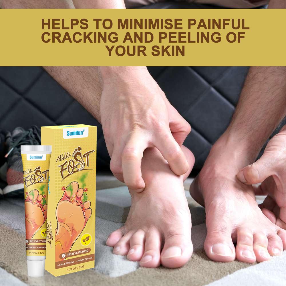 Бытовой крем от запаха ног, мазь, уход за ногами, устранение дискомфорта, упражнения для ног, очистка и освежение запаха пота ног.