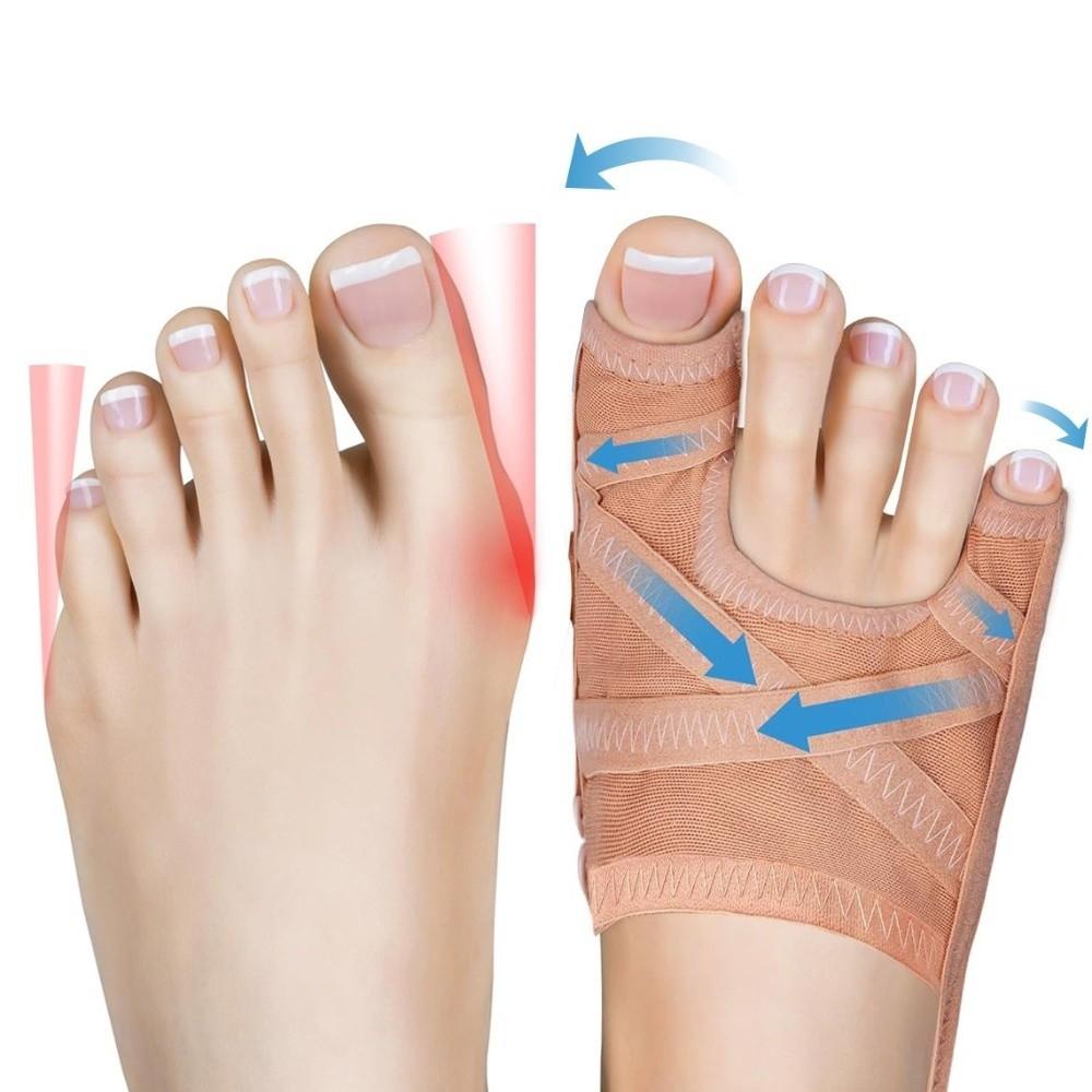 Comfortable Fit Bunion Corrector Adjustable Design Hallux Valgus Corrector  Daily Wear