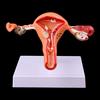 Pathological Uterus Ovary Anatomical Model Anatomy Cross Section Study Tool