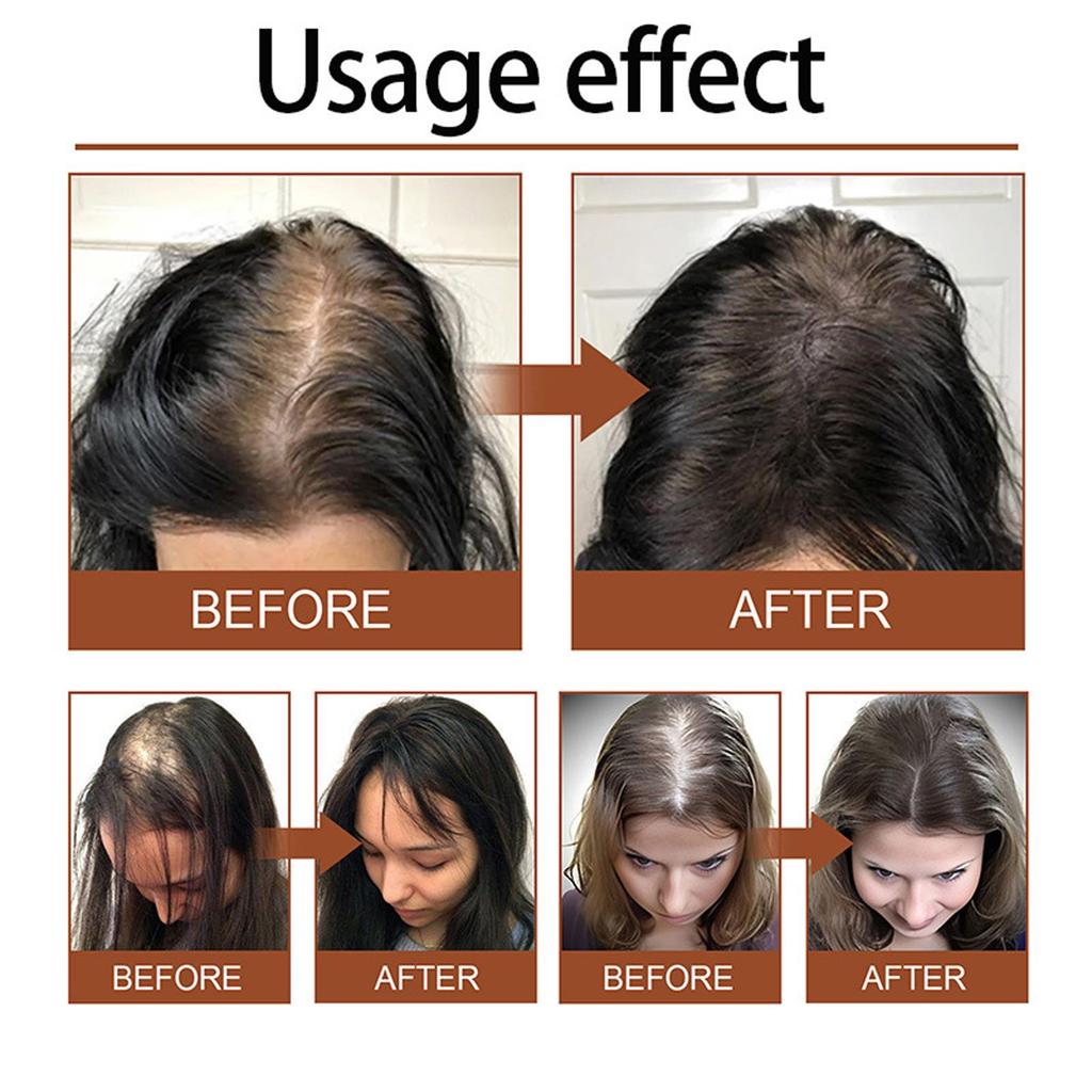 Масло розмарина Batana Уход за волосами Предотвращение ломкости волос Рост волос Предотвращение выпадения волос Уход за волосами Питательный спрей для кожи головы 20 мл